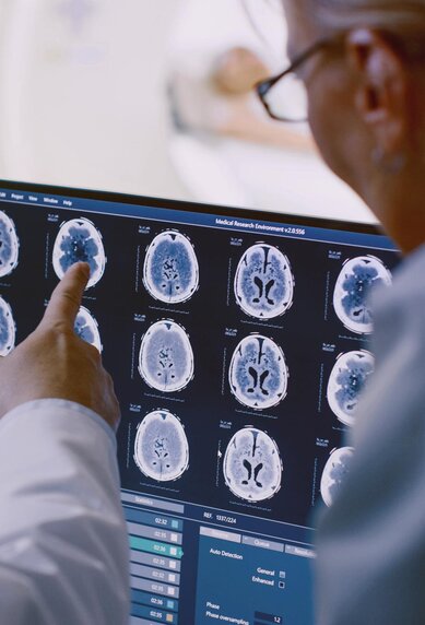 Ärzte betrachten und diskutieren medizinische Bildgebungen von Gehirnscans auf mehreren Bildschirmen, wobei einer der Ärzte auf einen bestimmten Scan zeigt.